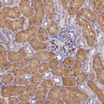 Immunohistochemistry-Paraffin: OSGEP Antibody [NBP1-83378] - Staining of human kidney shows moderate cytoplasmic positivity in cells in tubules and subset of cells in renal glomeruli.