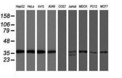 Western Blot: OSGEP Antibody (OTI9E3) - Azide and BSA Free [NBP2-73163] - Analysis of extracts (35ug) from 9 different cell lines by using anti-OSGEP monoclonal antibody.