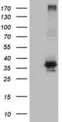 Western Blot: OSGEP Antibody (OTI9E3) - Azide and BSA Free [NBP2-73163] - HEK293T cells were transfected with the pCMV6-ENTRY control (Left lane) or pCMV6-ENTRY OSGEP (Right lane) cDNA for 48 hrs and lysed. Equivalent amounts of cell lysates (5 ug per lane) were separated by SDS-PAGE and immunoblotted with anti-OSGEP.