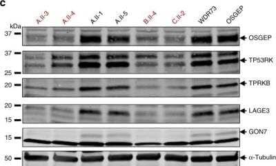 Western Blot: OSGEP Antibody (OTI9E3) [NBP2-00823] - Role of GON7 on KEOPS complex stability. Western blot analysis of protein expression level of the five KEOPS subunits, including LAGE3 (NBP2-32715), in lymphoblastoid cell lines from two unaffected relatives (A.II-1 and A.II-5), four individuals with the GON7 mutation p.Tyr*7, one individual with the OSGEP antibody mutations p.Arg325Gln and p.Arg280His, and one individual with GAMOS linked to WDR73 mutations. One representative western blot is shown (three independent experiments were performed). Alpha-Tubulin was used as a loading control. Image collected and cropped by CiteAb from the following publication (//www.ncbi.nlm.nih.gov/pmc/articles/PMC6722078/) licensed under a CC-BY license.