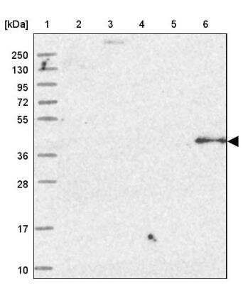 Western Blot: OSGEP Antibody [NBP1-83378] - Lane 1: Marker  [kDa] 250, 130, 95, 72, 55, 36, 28, 17, 10.  Lane 2: Human cell line RT-4.  Lane 3: Human cell line U-251MG sp.  Lane 4: Human plasma (IgG/HSA depleted).  Lane 5: Human liver tissue.  Lane 6: Human tonsil tissue