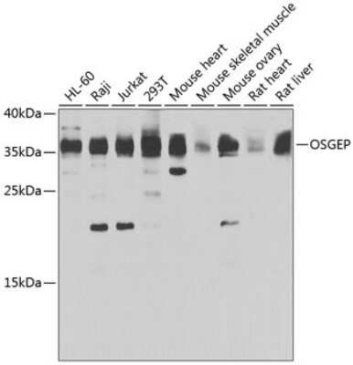 Western Blot: OSGEP Antibody [NBP2-93164] - Analysis of extracts of various cell lines, using OSGEP at 1:1000 dilution.Secondary antibody: HRP Goat Anti-Rabbit IgG (H+L) at 1:10000 dilution.Lysates/proteins: 25ug per lane.Blocking buffer: 3% nonfat dry milk in TBST.Detection: ECL Basic Kit .Exposure time: 30s.