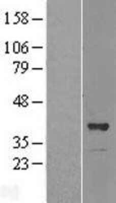 Western Blot: OSGEP Overexpression Lysate (Adult Normal) [NBL1-13999] Left-Empty vector transfected control cell lysate (HEK293 cell lysate); Right -Over-expression Lysate for OSGEP.