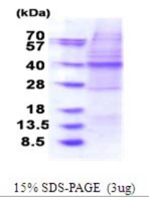 SDS-Page: OSGEP Recombinant Protein [NBP2-51805] - 15% SDS Page (3 ug)