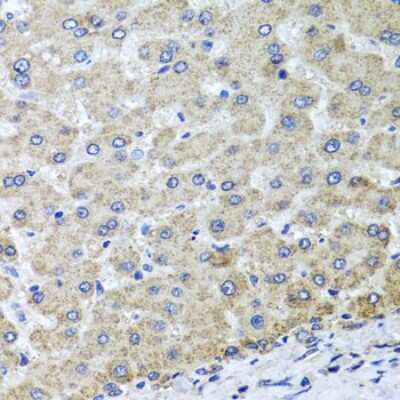 Immunohistochemistry-Paraffin: OSGEPL1 Antibody [NBP2-93751] - Paraffin-embedded human liver damage using OSGEPL1 .