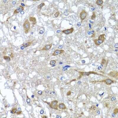 Immunohistochemistry-Paraffin: OSGEPL1 Antibody [NBP2-93751] - Paraffin-embedded rat brain using OSGEPL1 .