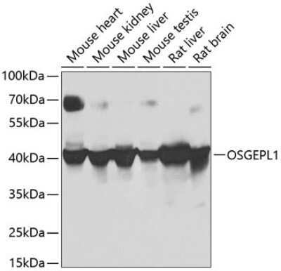 Western Blot: OSGEPL1 Antibody [NBP2-93751] - Analysis of extracts of various cell lines, using OSGEPL1 at 1:1000 dilution.Secondary antibody: HRP Goat Anti-Rabbit IgG (H+L) at 1:10000 dilution.Lysates/proteins: 25ug per lane.Blocking buffer: 3% nonfat dry milk in TBST.Detection: ECL Basic Kit .Exposure time: 30s.