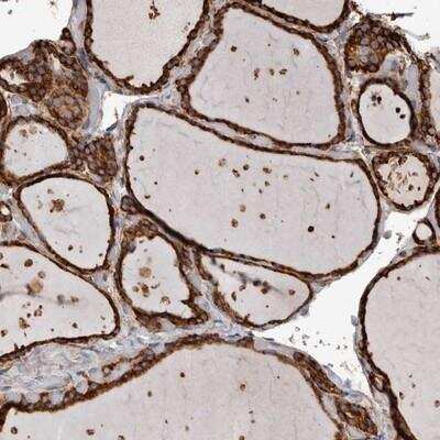 Immunohistochemistry: OSGIN2 Antibody [NBP1-86723] - Staining of human thyroid gland shows strong cytoplasmic positivity in glandular cells.
