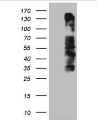 Western Blot: OSGIN2 Antibody (OTI7D12) [NBP2-46302] - HEK293T cells were transfected with the pCMV6-ENTRY control (Left lane) or pCMV6-ENTRY OSGIN2, (Right lane) cDNA for 48 hrs and lysed. Equivalent amounts of cell lysates (5 ug per lane) were separated by SDS-PAGE and immunoblotted with antiOSGIN2.(1:2000)