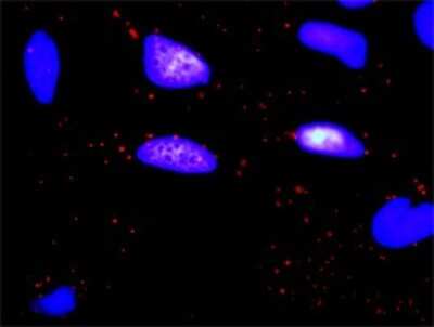 Proximity Ligation Assay: OSMR Antibody [H00009180-D01P] - Analysis of protein-protein interactions between OSMR and ERBB2. HeLa cells were stained with anti-OSMR rabbit purified polyclonal 1:1200 and anti-ERBB2 mouse monoclonal antibody 1:50. Each red dot represents the detection of protein-protein interaction complex, and nuclei were counterstained with DAPI (blue).