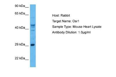 Western Blot: OSR1 Antibody [NBP2-86740] - Host: Rabbit. Target Name: OSR1. Sample Tissue: Mouse Heart lysates. Antibody Dilution: 1ug/ml