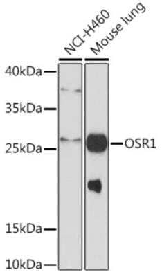 Western Blot: OSR1 Antibody [NBP2-94383] - Western blot analysis of extracts of various cell lines, using OSR1 antibody at 1:1000 dilution. Secondary antibody: HRP Goat Anti-Rabbit IgG (H+L) at 1:10000 dilution. Lysates/proteins: 25ug per lane. Blocking buffer: 3% nonfat dry milk in TBST.Detection: ECL Basic Kit. Exposure time: 90s.