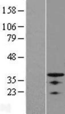 Western Blot: OSR1 Overexpression Lysate (Adult Normal) [NBL1-14003] Left-Empty vector transfected control cell lysate (HEK293 cell lysate); Right -Over-expression Lysate for OSR1.