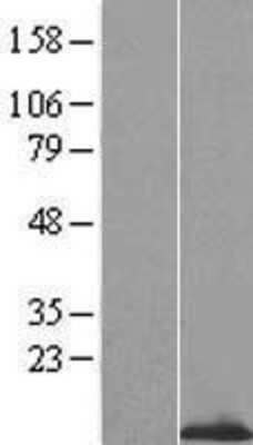 Western Blot: OSTB Overexpression Lysate (Adult Normal) [NBP2-04938] Left-Empty vector transfected control cell lysate (HEK293 cell lysate); Right -Over-expression Lysate for OSTB.