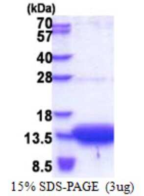 SDS-PAGE Recombinant Human OSTB His Protein