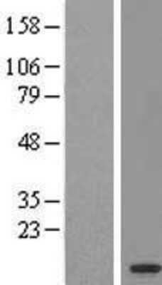 Western Blot: OSTCL Overexpression Lysate (Adult Normal) [NBL1-12585] Left-Empty vector transfected control cell lysate (HEK293 cell lysate); Right -Over-expression Lysate for OSTCL.