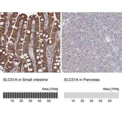 Immunohistochemistry-Paraffin: OSTalpha Antibody [NBP1-87507] - Staining in human small intestine and pancreas tissues using anti-SLC51A antibody. Corresponding SLC51A RNA-seq data are presented for the same tissues.