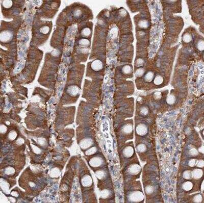 Immunohistochemistry-Paraffin: OSTalpha Antibody [NBP1-87507] -  Staining of human small intestine shows high expression.