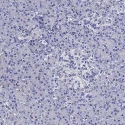 Immunohistochemistry-Paraffin OSTalpha Antibody - BSA Free
