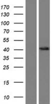 Western Blot: OSTalpha Overexpression Lysate (Adult Normal) [NBP2-04427] Left-Empty vector transfected control cell lysate (HEK293 cell lysate); Right -Over-expression Lysate for OSTalpha.