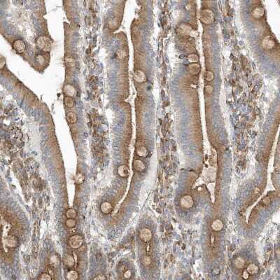 Immunohistochemistry-Paraffin: OTOP1 Antibody [NBP1-86306] - Staining of human duodenum shows moderate membranous positivity in glandular cells.