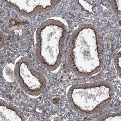 Immunohistochemistry-Paraffin: OTOP1 Antibody [NBP1-86306] - Staining of human endometrium shows strong membranous positivity in glandular cells.