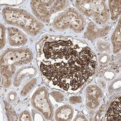 Immunohistochemistry-Paraffin: OTOP1 Antibody [NBP1-86306] - Staining of human kidney shows strong membranous positivity in cells in glomeruli.