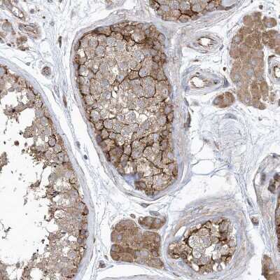 Immunohistochemistry-Paraffin: OTOP1 Antibody [NBP1-86306] - Staining of human testis shows strong membranous positivity in cells in seminiferous ducts.