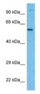 Western Blot OTOP3 Antibody