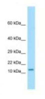 Western Blot: OTOS Antibody [NBP1-98417] - Mouse Pancreas Lysate 1.0ug/ml, Gel Concentration: 10-20%