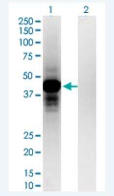 Western Blot: OTP Antibody (8E12) [H00023440-M03-100ug] - Analysis of OTP expression in transfected 293T cell line by OTP monoclonal antibody (M03), clone 8E12.  Lane 1: OTP transfected lysate (Predicted MW: 34.2 KDa). Lane 2: Non-transfected lysate.