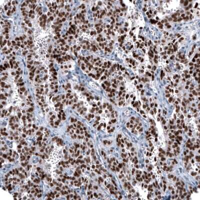 Immunohistochemistry-Paraffin OTP Antibody (CL11225)