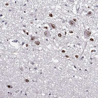 Immunohistochemistry-Paraffin: OTP Antibody [NBP2-68751] - Immunohistochemical staining of human hypothalamus shows strong nuclear positivity in subsets of neuronal cells.