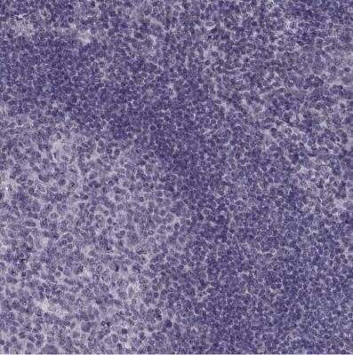 Immunohistochemistry-Paraffin: OTP Antibody [NBP2-68751] - Staining of human tonsil shows no positivity in germinal center cells as expected.