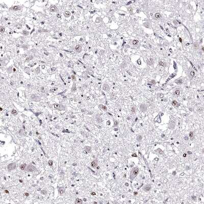 Immunohistochemistry-Paraffin: OTP Antibody [NBP2-68751] - Staining of human hypothalamus shows nuclear positivity in neurons.