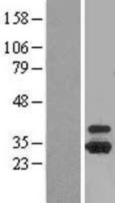 Western Blot: OTUB1 Overexpression Lysate (Adult Normal) [NBL1-14011] Left-Empty vector transfected control cell lysate (HEK293 cell lysate); Right -Over-expression Lysate for OTUB1.