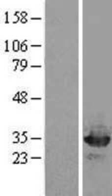 Western Blot: OTUB2 Overexpression Lysate (Adult Normal) [NBL1-14012] Left-Empty vector transfected control cell lysate (HEK293 cell lysate); Right -Over-expression Lysate for OTUB2.