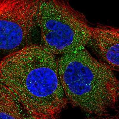 Immunocytochemistry/Immunofluorescence: OTUD3 Antibody [NBP1-90486] - Immunofluorescent staining of human cell line A-431 shows localization to cytosol.
