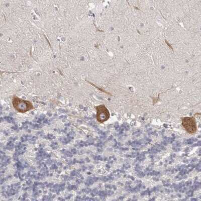 Immunohistochemistry-Paraffin: OTUD3 Antibody [NBP1-90486] - Staining of human cerebellum shows strong cytoplasmic positivity in purkinje cells.