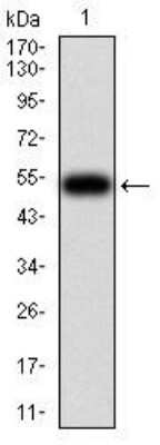 Western Blot: OTUD4 Antibody (3B12G11) [NBP2-52525] - Analysis using OTUD4 mAb against human OTUD4 (AA: 815-1049) recombinant protein. (Expected MW is 52.2 kDa)