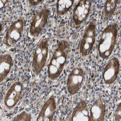 Immunohistochemistry-Paraffin: OTUD5 Antibody [NBP1-85044] - Staining of human rectum shows cytoplasmic positivity in glandular cells.