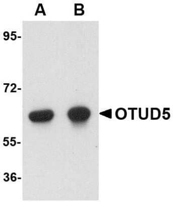 Western Blot: OTUD5 Antibody [NBP1-76943] - Human kidney lysate with OTUD5 antibody at (A) 1 and (B) 2 ug/mL.