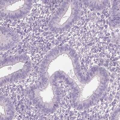 Immunohistochemistry-Paraffin: OTUD6A Antibody [NBP2-49078] - Staining of human endometrium shows low expression as expected.