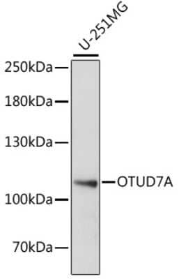 Western Blot: OTUD7A Antibody [NBP2-93314] - Analysis of extracts of U-251MG cells, using OTUD7A at 1:1000 dilution.Secondary antibody: HRP Goat Anti-Rabbit IgG (H+L) at 1:10000 dilution.Lysates/proteins: 25ug per lane.Blocking buffer: 3% nonfat dry milk in TBST.Detection: ECL Basic Kit .Exposure time: 30s.