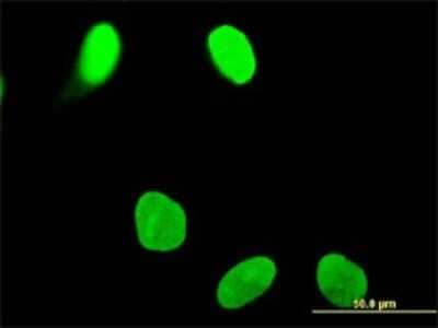 Immunocytochemistry/Immunofluorescence: OTUD7B/Cezanne/ZA20D1 Antibody (2B4) [H00056957-M01] - Analysis of monoclonal antibody to OTUD7B on HeLa cell . Antibody concentration 10 ug/ml.