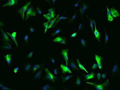 Immunocytochemistry/Immunofluorescence: OTUD7B/Cezanne/ZA20D1 Antibody [NBP2-97842] - Immunofluorescence staining of OTUD7B/Cezanne/ZA20D1 in U251MG cells. Cells were fixed with 4% PFA, permeabilzed with 0.1% Triton X-100 in PBS, blocked with 10% serum, and incubated with rabbit anti-Human OTUD7B/Cezanne/ZA20D1 polyclonal antibody (dilution ratio 1:200) at 4C overnight. Then cells were stained with the Alexa Fluor(R)488-conjugated Goat Anti-rabbit IgG secondary antibody (green) and counterstained with DAPI (blue).Positive staining was localized to Cytoplasm.