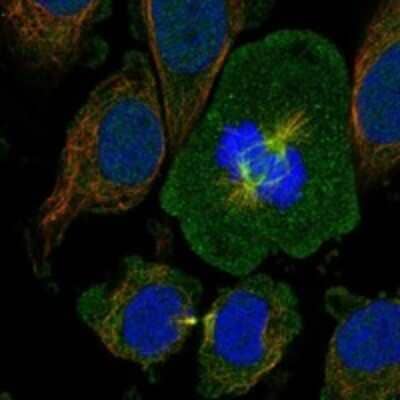 Immunocytochemistry/Immunofluorescence: OTUD7B/Cezanne/ZA20D1 Antibody [NBP3-17748] - Staining of human cell line SiHa shows localization to microtubules, cytokinetic bridge & mitotic spindle.