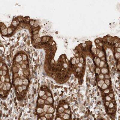 Immunohistochemistry-Paraffin OTUD7B/Cezanne/ZA20D1 Antibody