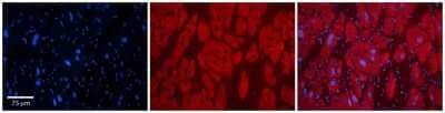 Immunohistochemistry-Paraffin: OTUD7B/Cezanne/ZA20D1 Antibody [NBP2-87998] - Rabbit Anti-OTUD7B Antibody. Formalin Fixed Paraffin Embedded Tissue: Human Adult heart. Observed Staining: Cytoplasmic. Primary Antibody Concentration: 1:600. Secondary Antibody: Donkey anti-Rabbit-Cy2/3.