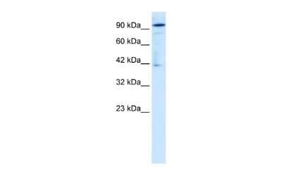 Western Blot: OTUD7B/Cezanne/ZA20D1 Antibody [NBP2-87997] - WB Suggested Anti-ZA20D1 Antibody Titration: 1.25ug/ml. ELISA Titer: 1:312500. Positive Control: Daudi cell lysateOTUD7B is supported by BioGPS gene expression data to be expressed in Daudi